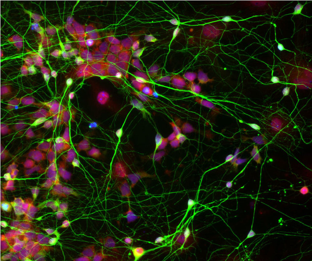 Image of brain neurons